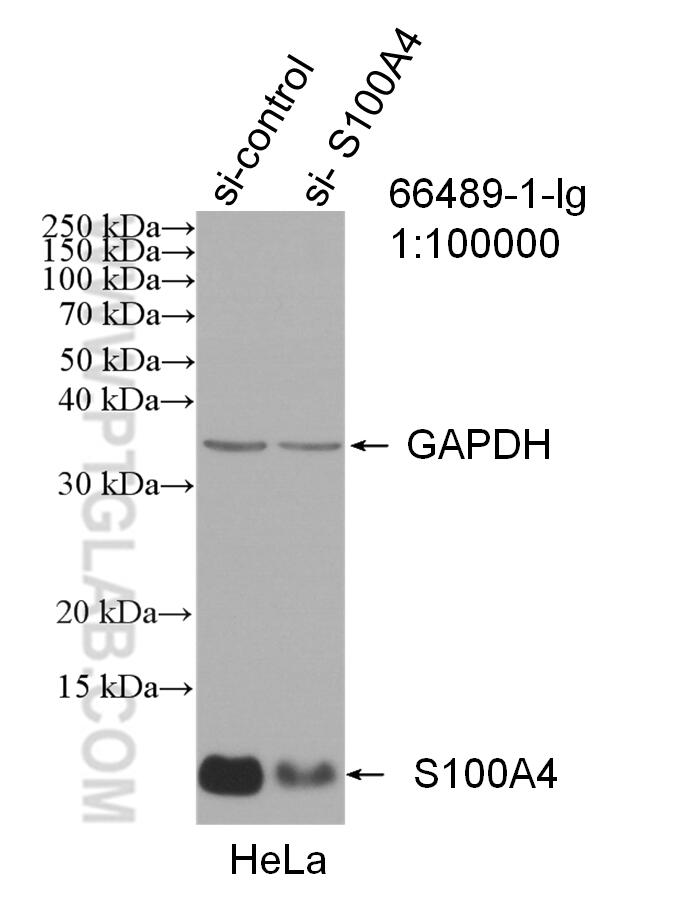 Western Blot (WB) analysis of HeLa cells using S100A4 Monoclonal antibody (66489-1-Ig)