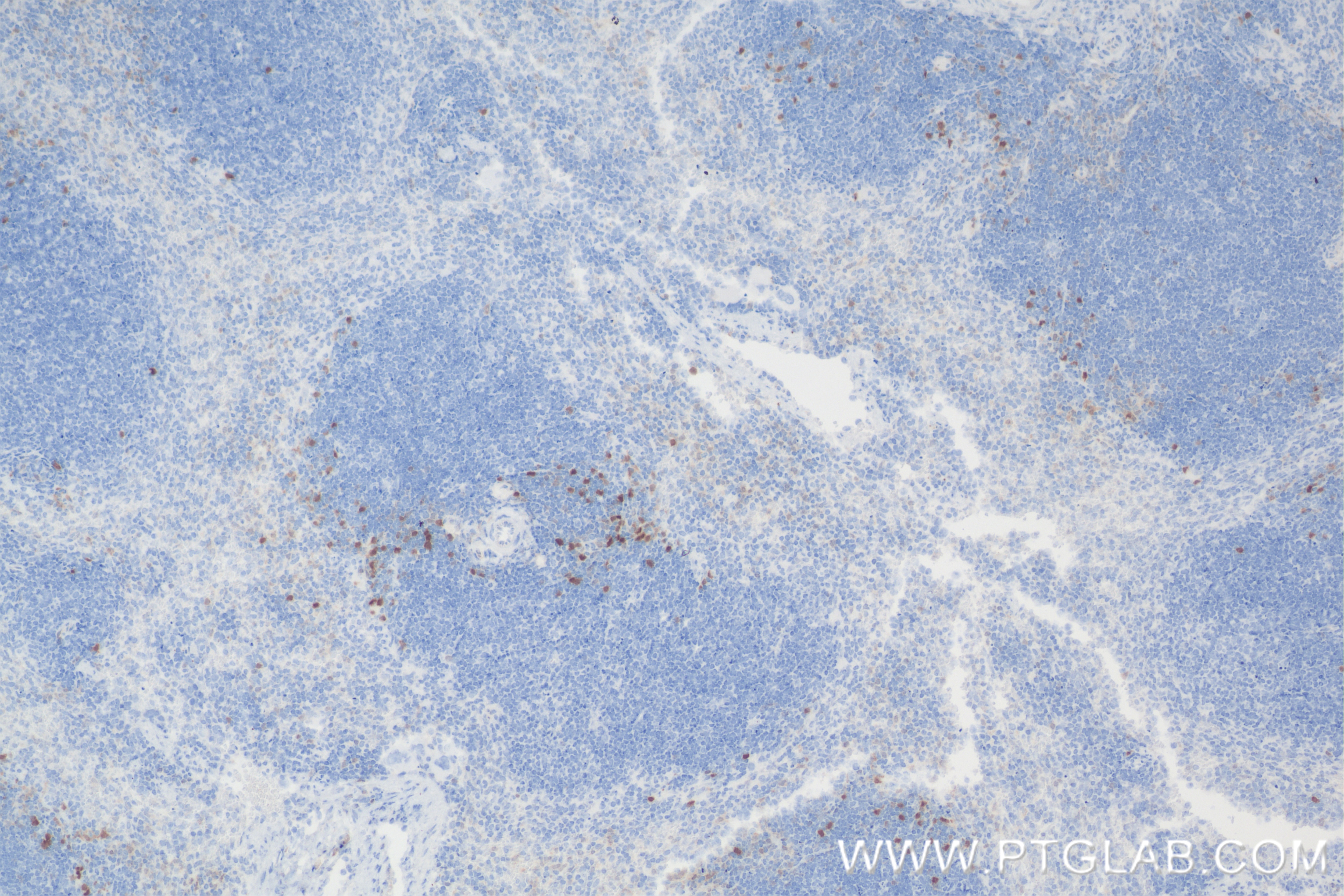 Immunohistochemistry (IHC) staining of mouse spleen tissue using S100A4 Recombinant antibody (84221-1-RR)