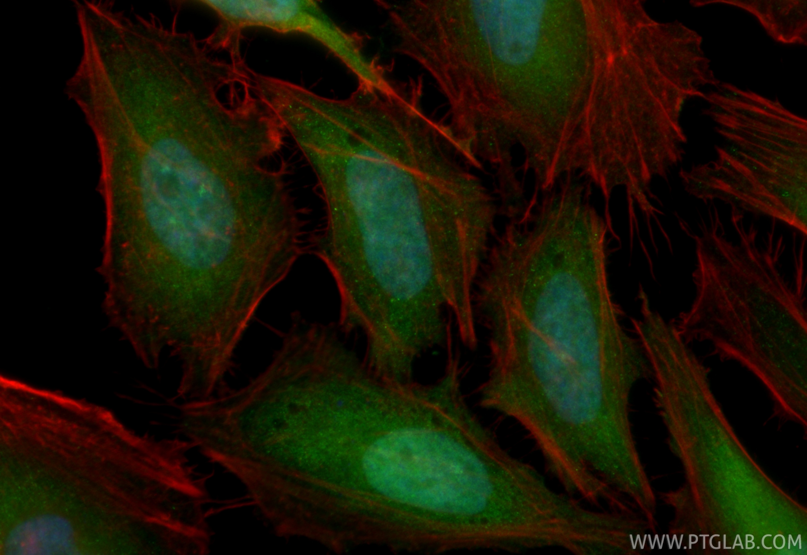 Immunofluorescent analysis of (4% PFA) fixed HeLa cells using CoraLite® Plus 488 S100A4 antibody (CL488-84221, Clone: 241448A12 ) at dilution of 1:200, CL594-Phalloidin (red). Immunofluorescence (IF) / fluorescent staining of HeLa cells using CoraLite® Plus 488-conjugated S100A4 Recombinant m (CL488-84221)
