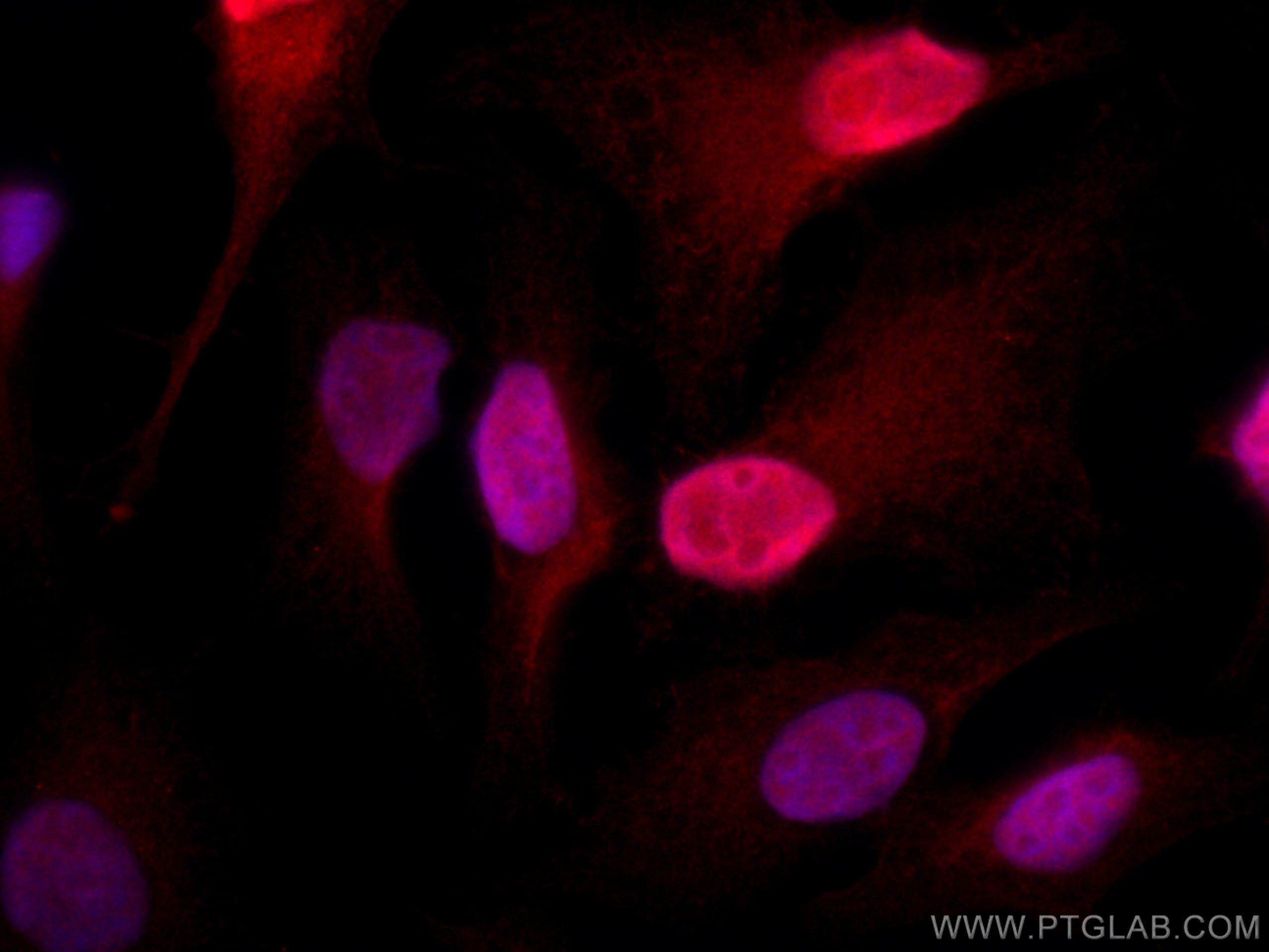 Immunofluorescence (IF) / fluorescent staining of HeLa cells using CoraLite®594-conjugated S100A4 Polyclonal antibody (CL594-16105)