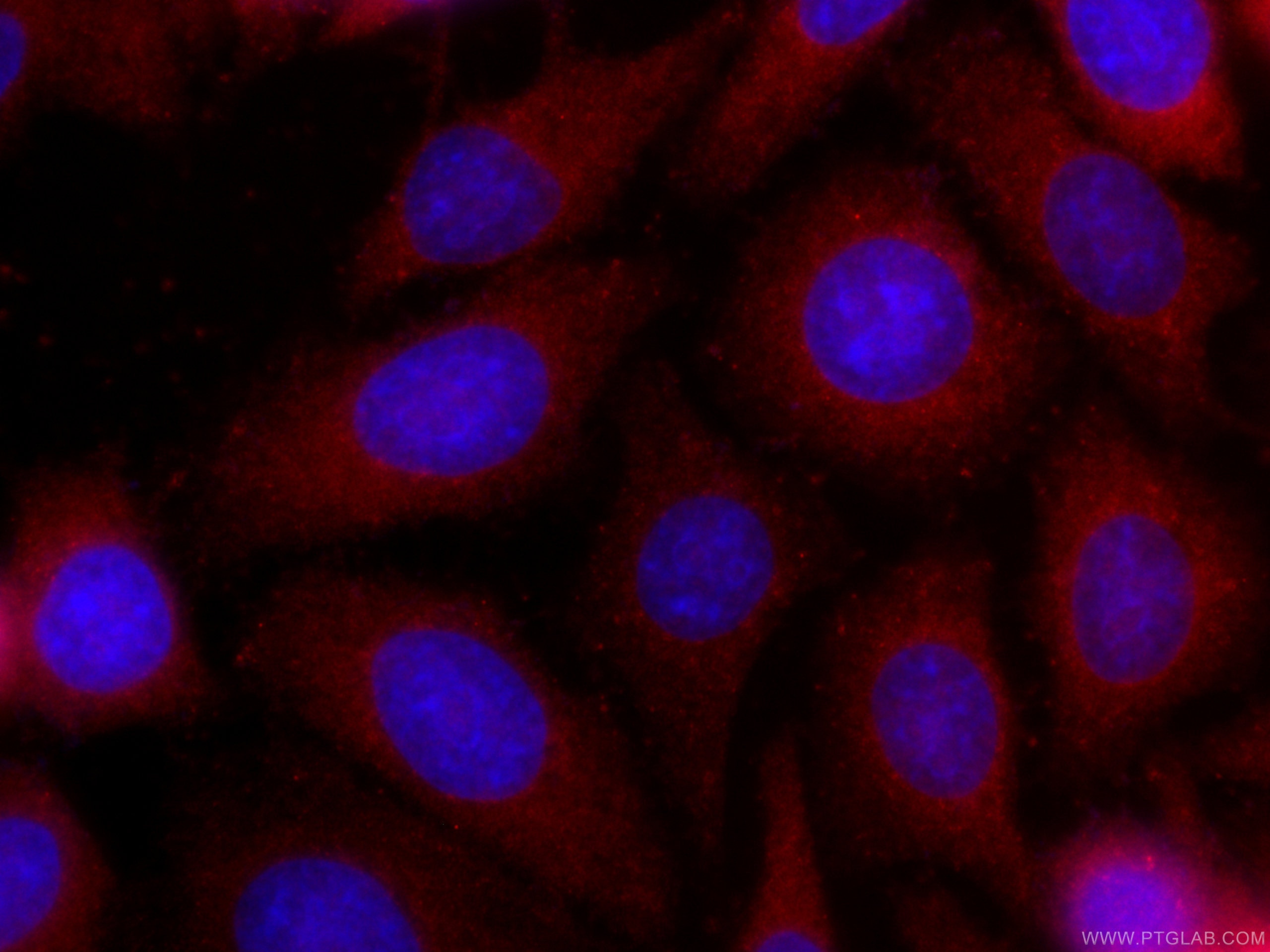 Immunofluorescence (IF) / fluorescent staining of HepG2 cells using CoraLite®594-conjugated S100A4 Monoclonal antibody (CL594-66489)