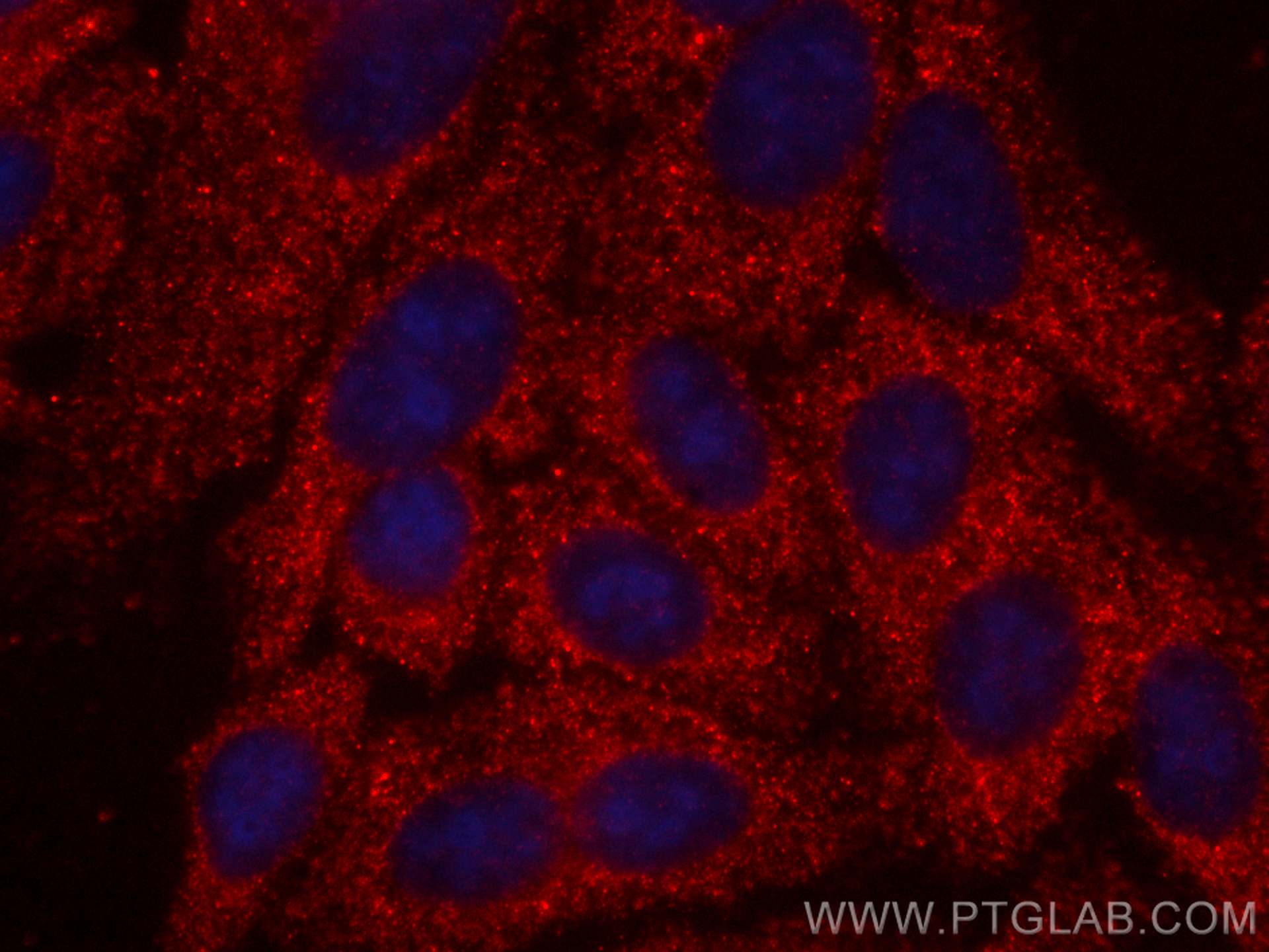 Immunofluorescence (IF) / fluorescent staining of HepG2 cells using CoraLite®594-conjugated S100A4 Monoclonal antibody (CL594-66489)