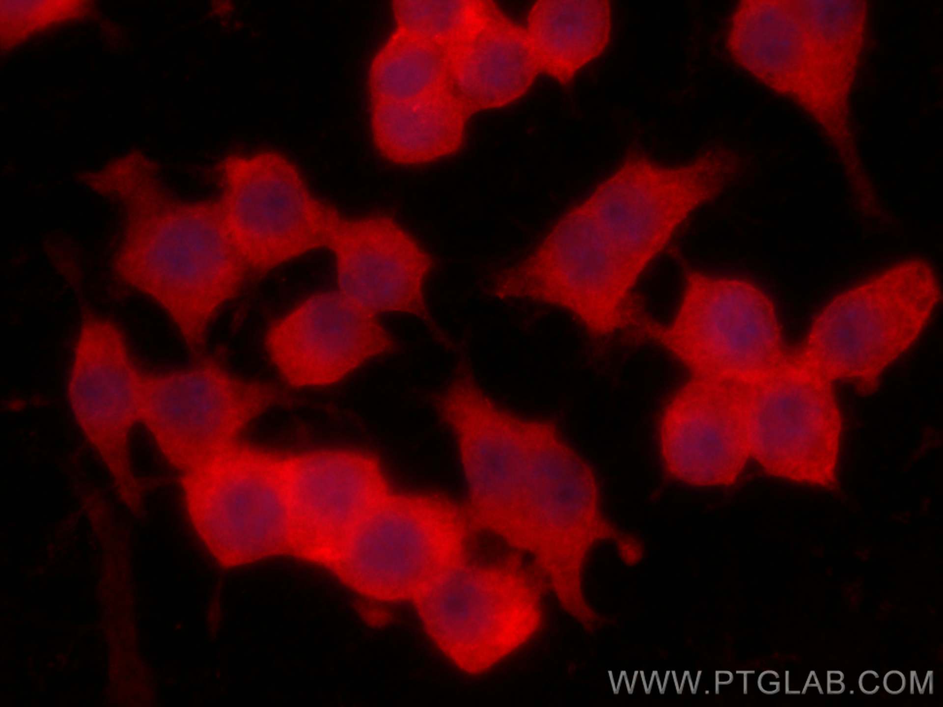 Immunofluorescence (IF) / fluorescent staining of RAW 264.7 cells using CoraLite®594-conjugated S100A4 Monoclonal antibody (CL594-66489)