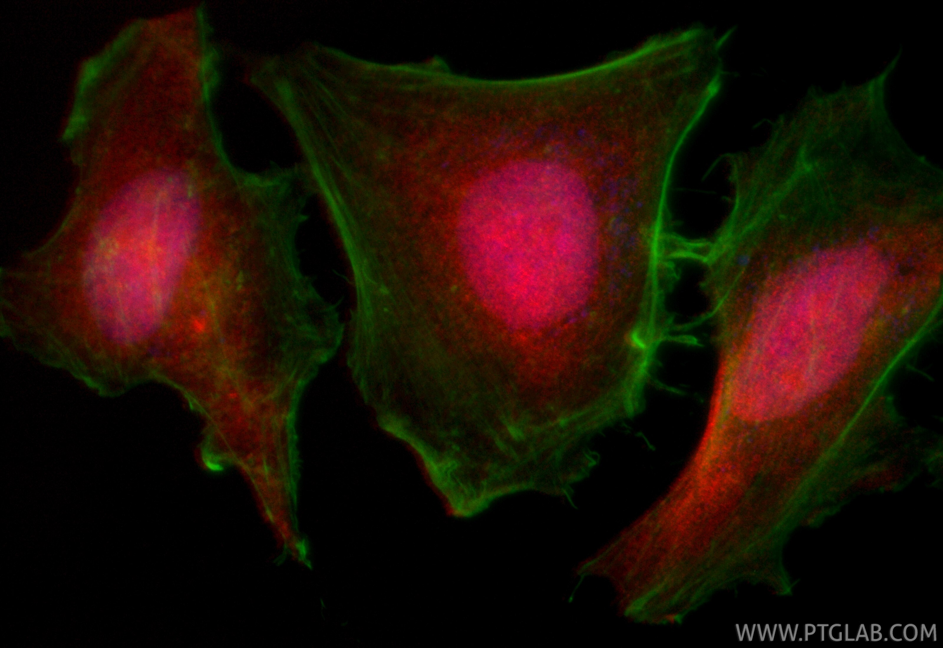 Immunofluorescence (IF) / fluorescent staining of HeLa cells using CoraLite®594-conjugated S100A4 Recombinant monoclo (CL594-84221)