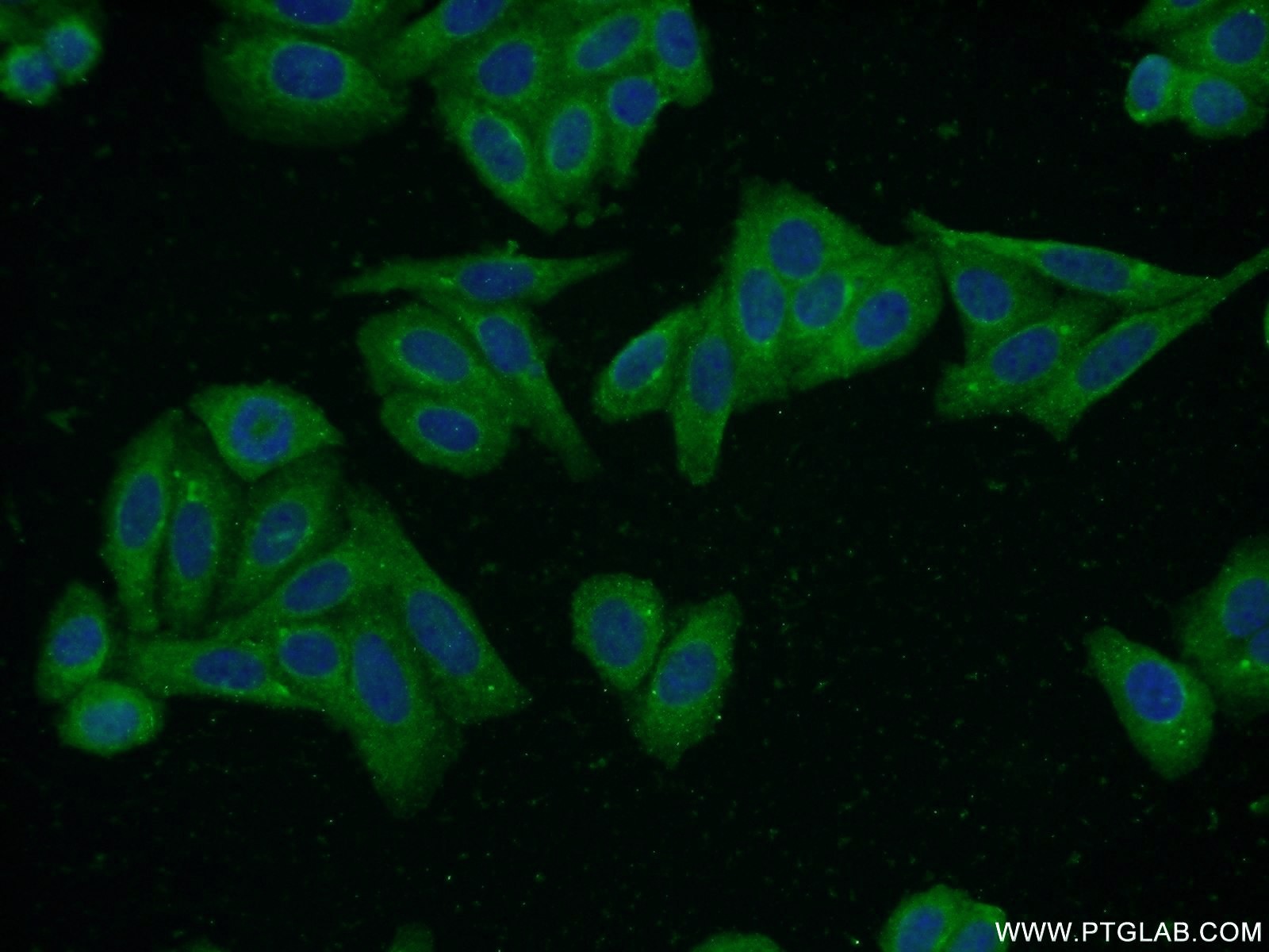 Immunofluorescence (IF) / fluorescent staining of HepG2 cells using S100A5 Polyclonal antibody (17924-1-AP)