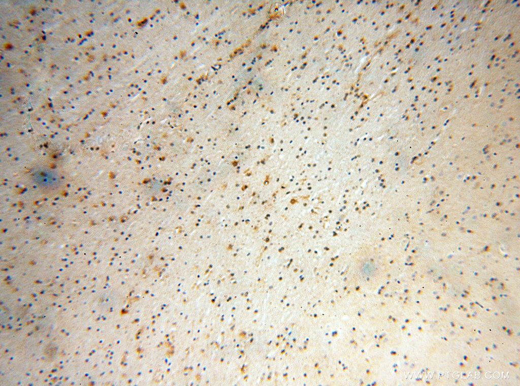 IHC staining of human brain using 17924-1-AP