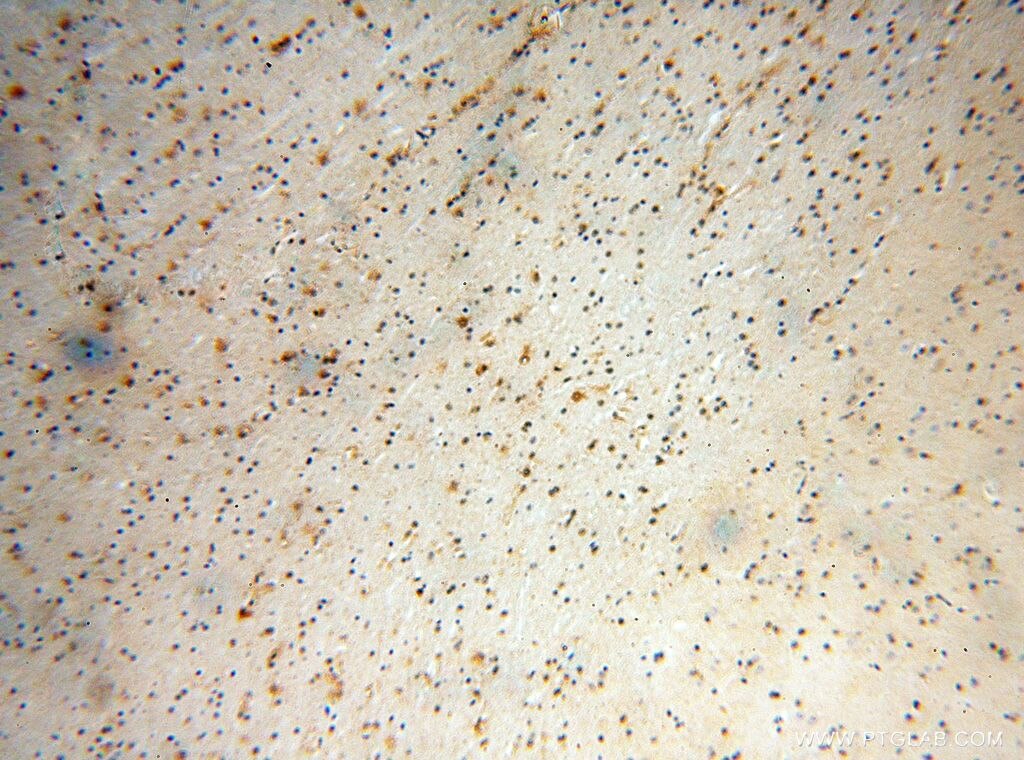 Immunohistochemistry (IHC) staining of human brain tissue using S100A5 Polyclonal antibody (17924-1-AP)