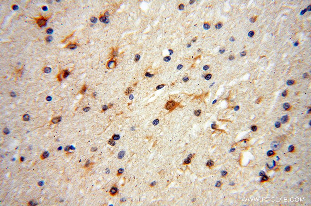 Immunohistochemistry (IHC) staining of human brain tissue using S100A5 Polyclonal antibody (17924-1-AP)