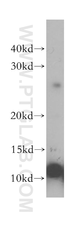 Western Blot (WB) analysis of human liver tissue using S100A5 Polyclonal antibody (17924-1-AP)