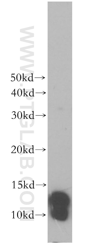 WB analysis of SH-SY5Y using 17924-1-AP