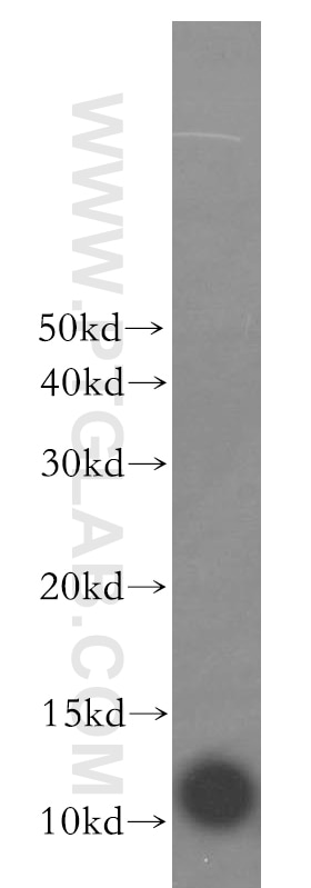 Western Blot (WB) analysis of human kidney tissue using S100A5 Polyclonal antibody (17924-1-AP)