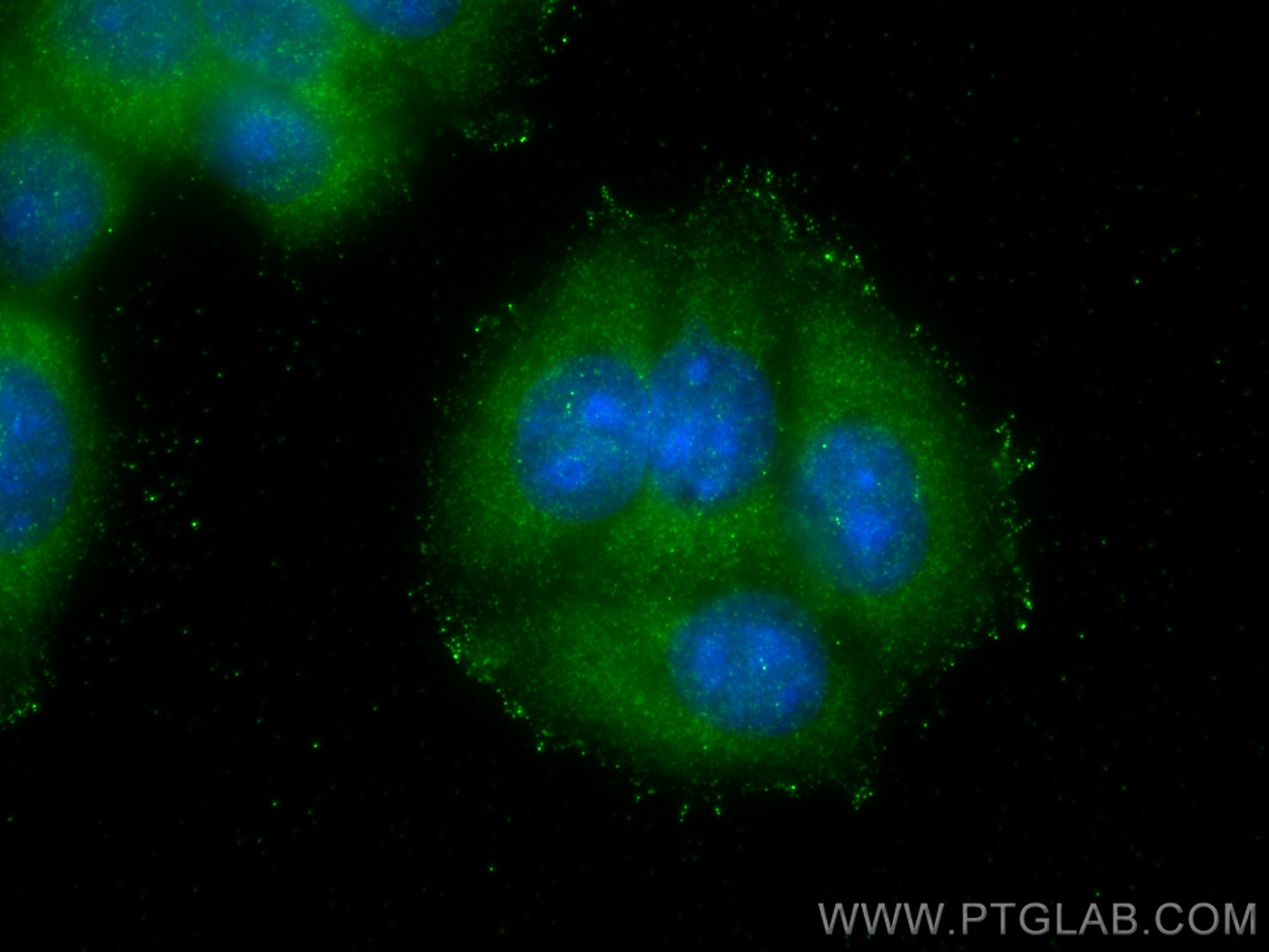 Immunofluorescence (IF) / fluorescent staining of MCF-7 cells using S100A6 Polyclonal antibody (10245-1-AP)