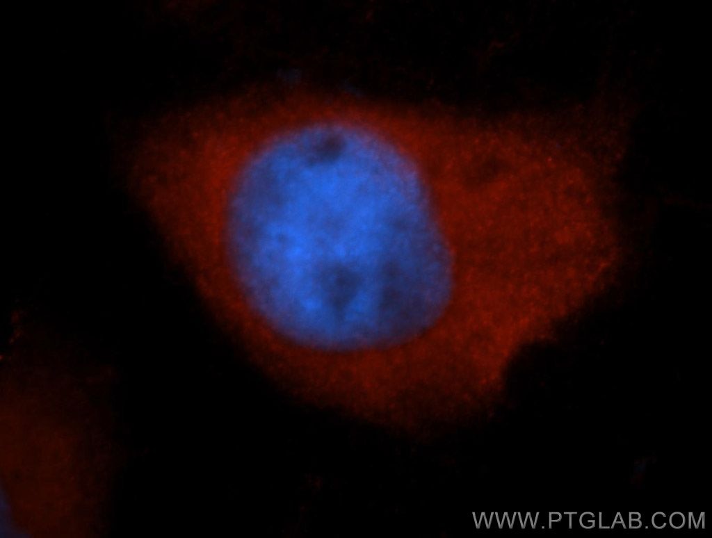Immunofluorescence (IF) / fluorescent staining of MCF-7 cells using S100A6 Polyclonal antibody (10245-1-AP)