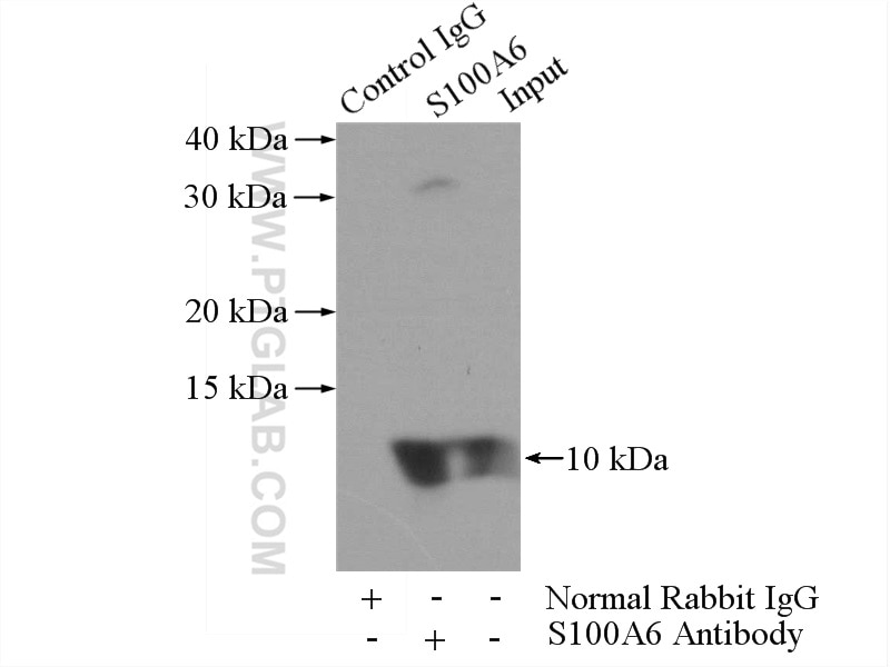 Immunoprecipitation (IP) experiment of A549 cells using S100A6 Polyclonal antibody (10245-1-AP)