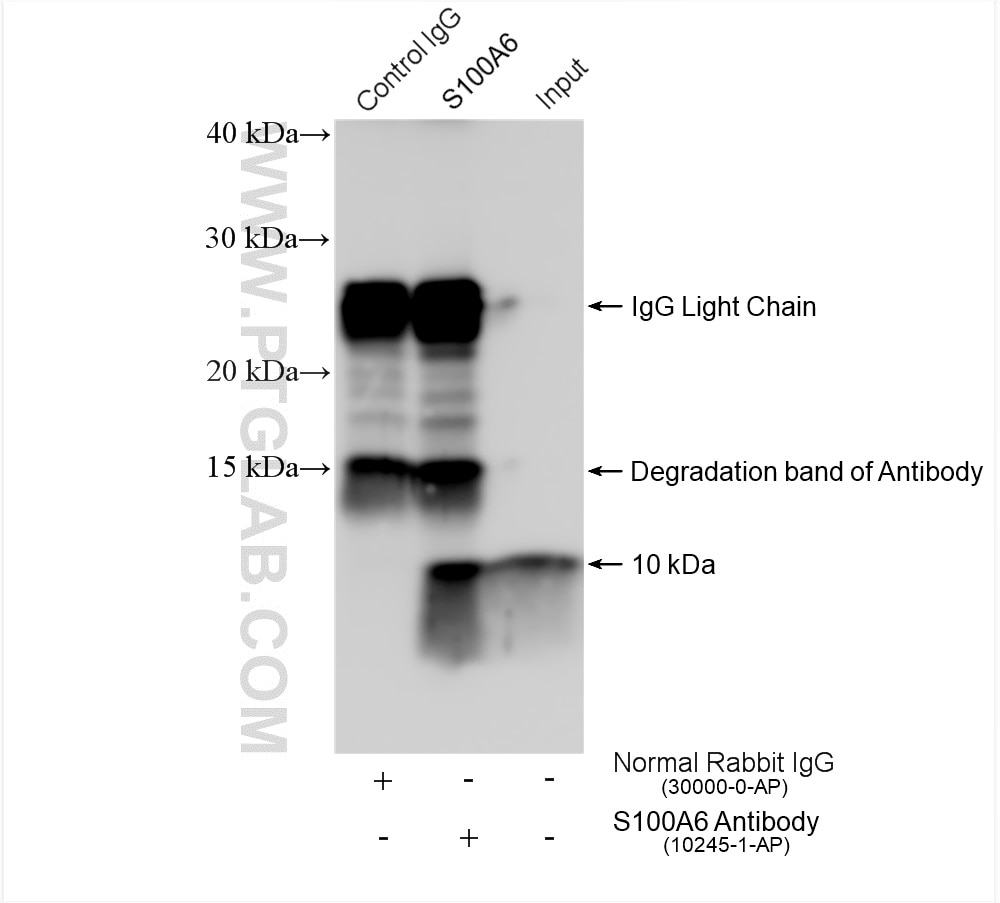 Immunoprecipitation (IP) experiment of A549 cells using S100A6 Polyclonal antibody (10245-1-AP)