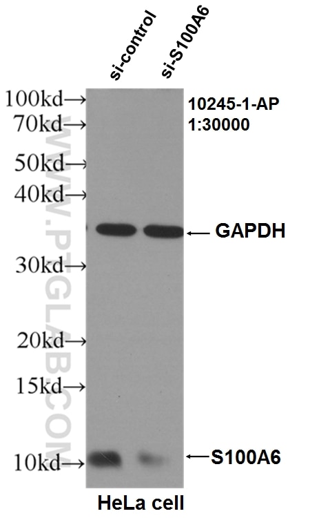 Western Blot (WB) analysis of HeLa cells using S100A6 Polyclonal antibody (10245-1-AP)