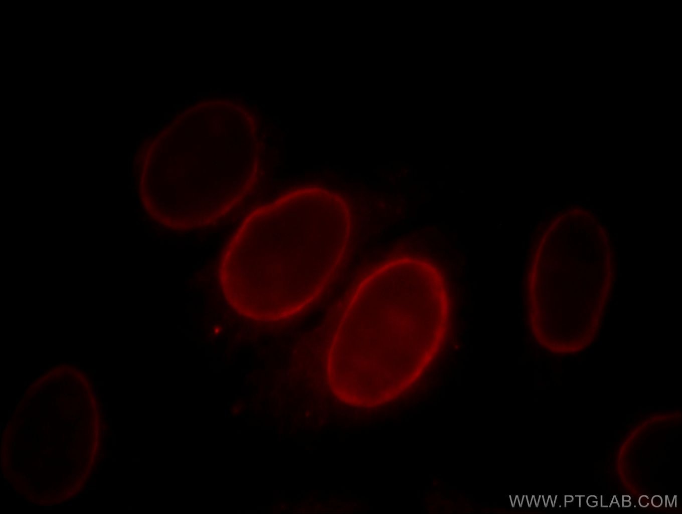 Immunofluorescence (IF) / fluorescent staining of HepG2 cells using S100A6 Monoclonal antibody (66098-1-Ig)