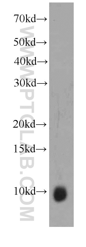 Western Blot (WB) analysis of HeLa cells using S100A6 Monoclonal antibody (66098-1-Ig)