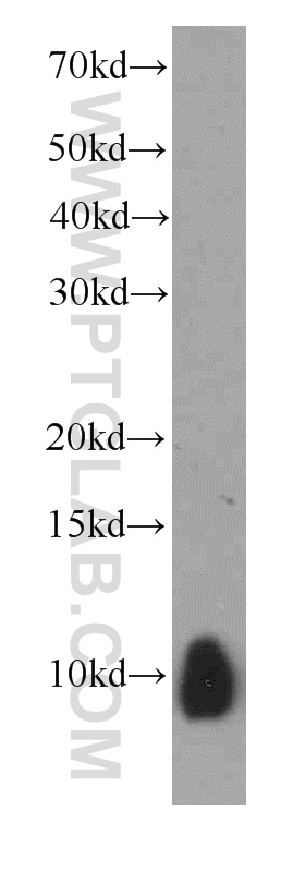 Western Blot (WB) analysis of A549 cells using S100A6 Monoclonal antibody (66098-1-Ig)