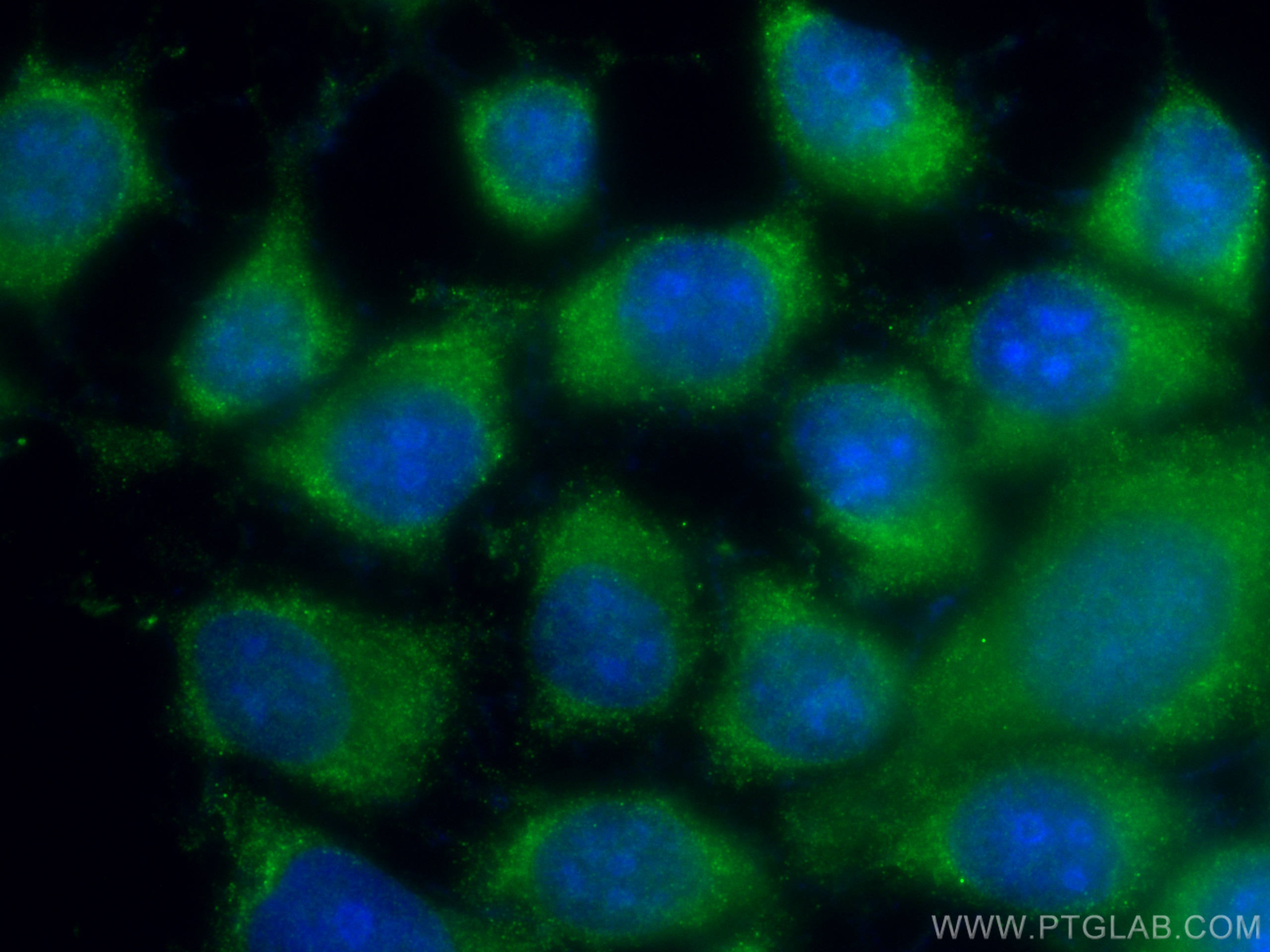 Immunofluorescence (IF) / fluorescent staining of MCF-7 cells using CoraLite® Plus 488-conjugated S100A6 Polyclonal an (CL488-10245)