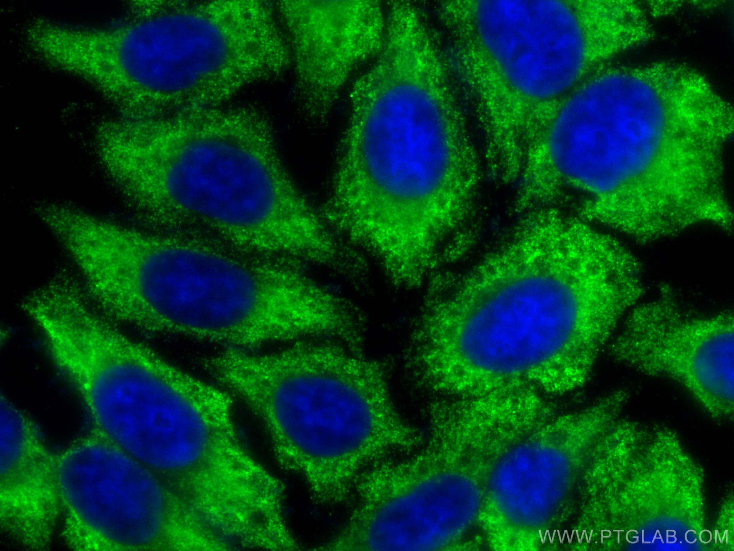 Immunofluorescence (IF) / fluorescent staining of HepG2 cells using CoraLite® Plus 488-conjugated S100A6 Monoclonal an (CL488-66098)