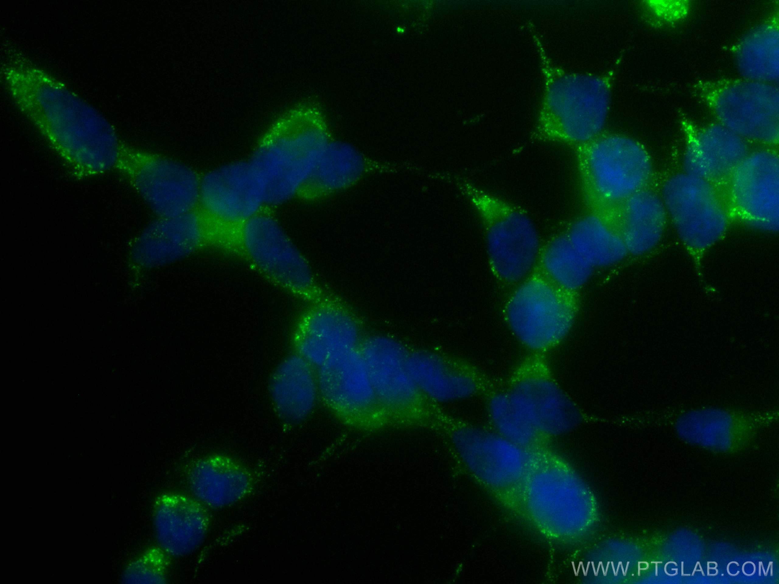 Immunofluorescence (IF) / fluorescent staining of SH-SY5Y cells using CoraLite® Plus 488-conjugated S100A6 Monoclonal an (CL488-66098)