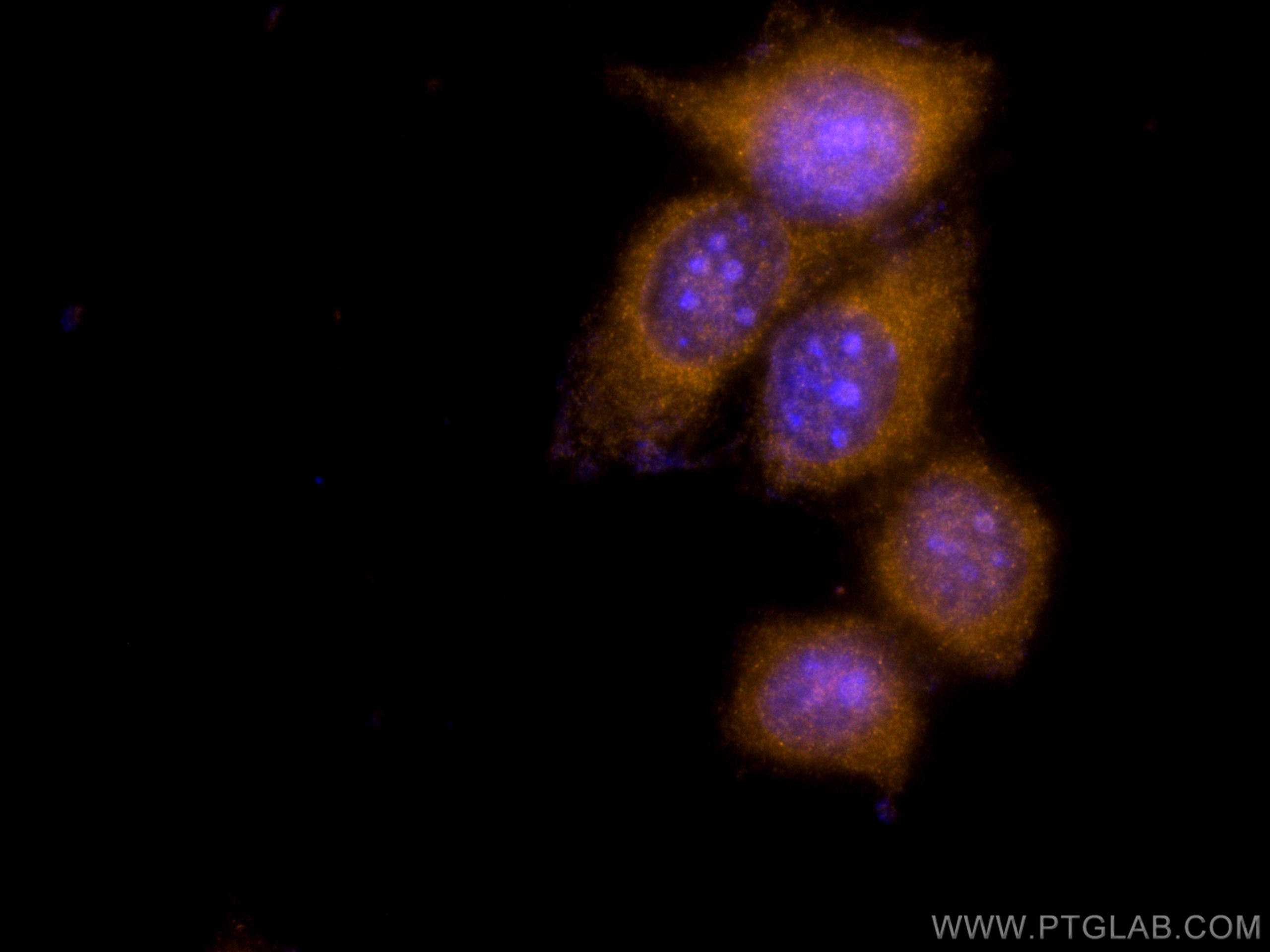 Immunofluorescence (IF) / fluorescent staining of MCF-7 cells using CoraLite®555-conjugated S100A6 Polyclonal antibody (CL555-10245)