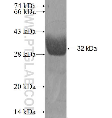 S100A6 fusion protein Ag0385 SDS-PAGE