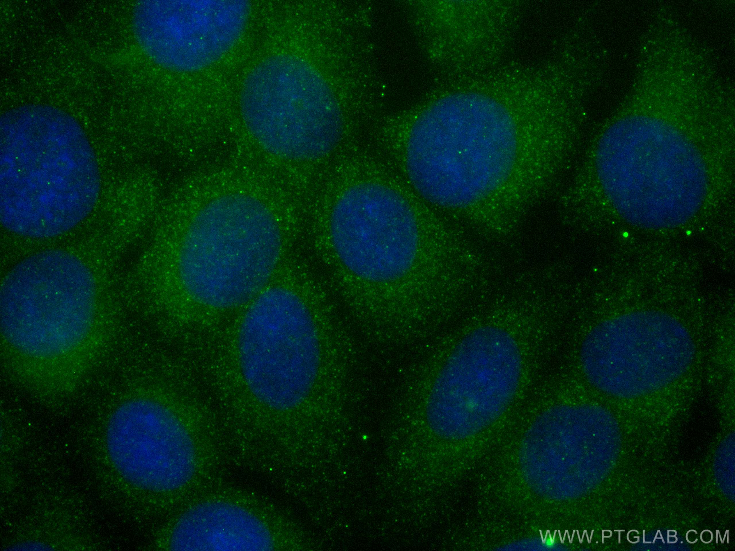 Immunofluorescence (IF) / fluorescent staining of MCF-7 cells using S100A7/Psoriasin Polyclonal antibody (13061-1-AP)