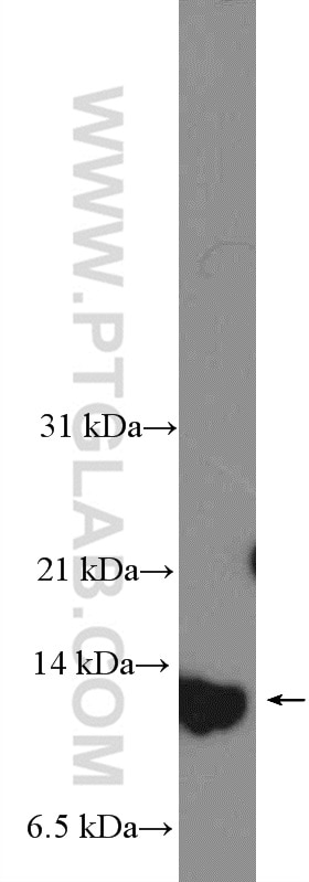 Western Blot (WB) analysis of MCF-7 cells using S100A7/Psoriasin Polyclonal antibody (13061-1-AP)