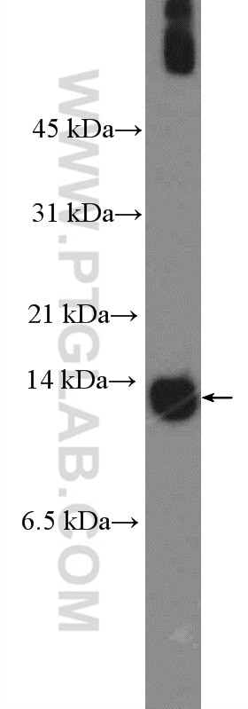 Western Blot (WB) analysis of MCF-7 cells using S100A7/Psoriasin Polyclonal antibody (26656-1-AP)