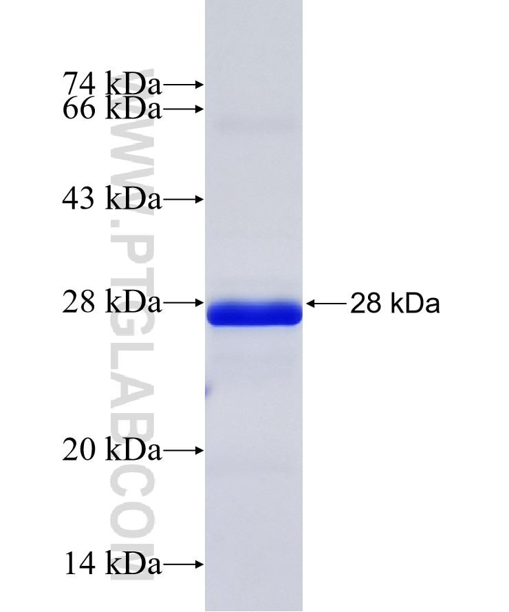 S100A8-A9 fusion protein Ag27455 SDS-PAGE