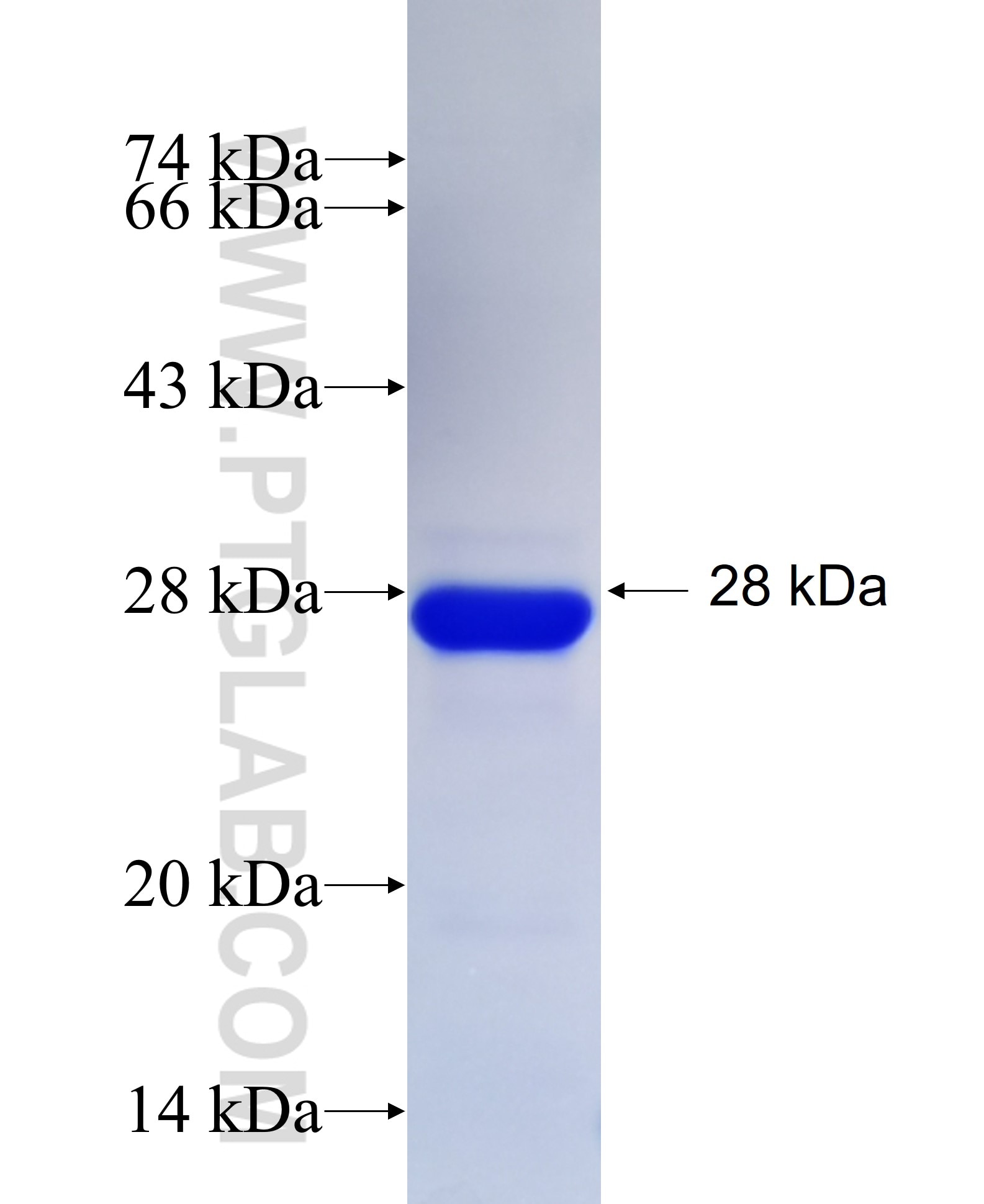 S100A8-A9 fusion protein Ag27455 SDS-PAGE