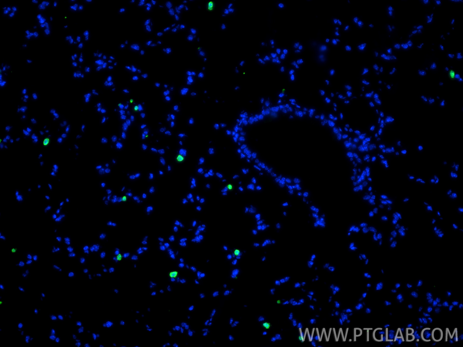Immunofluorescence (IF) / fluorescent staining of mouse lung tissue using S100A8 Polyclonal antibody (15792-1-AP)