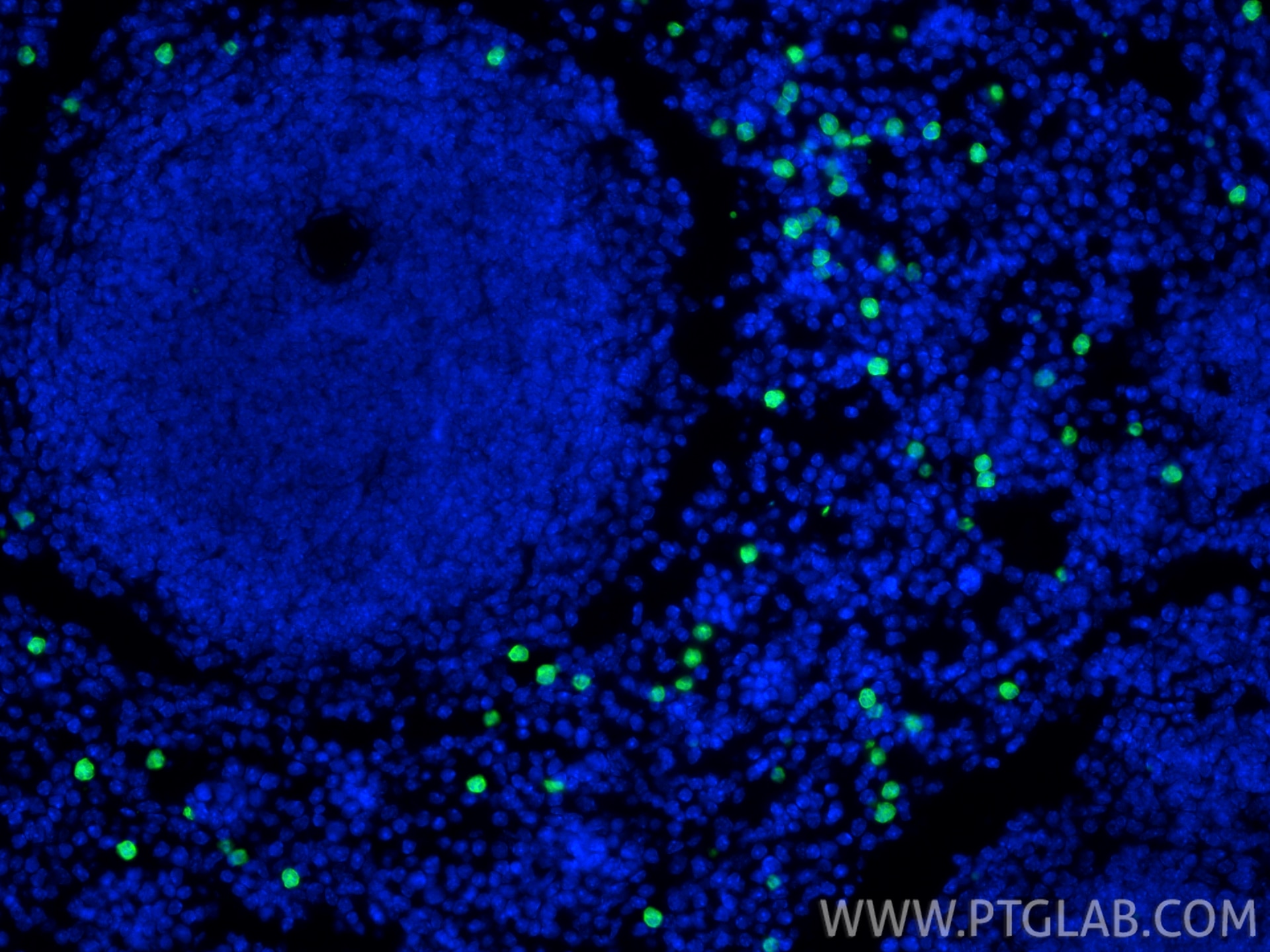 Immunofluorescence (IF) / fluorescent staining of mouse spleen tissue using S100A8 Polyclonal antibody (15792-1-AP)