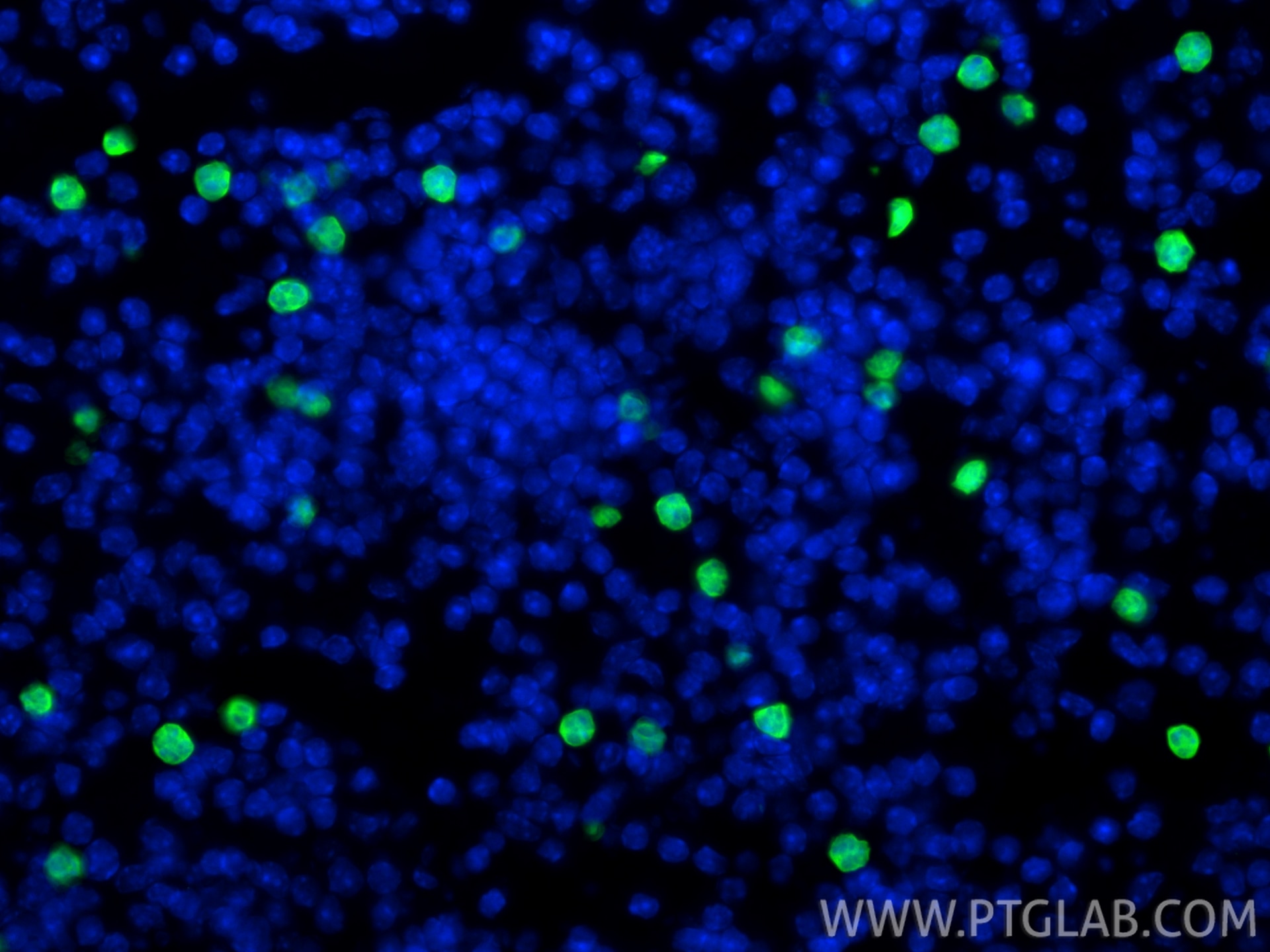 Immunofluorescence (IF) / fluorescent staining of mouse spleen tissue using S100A8 Polyclonal antibody (15792-1-AP)