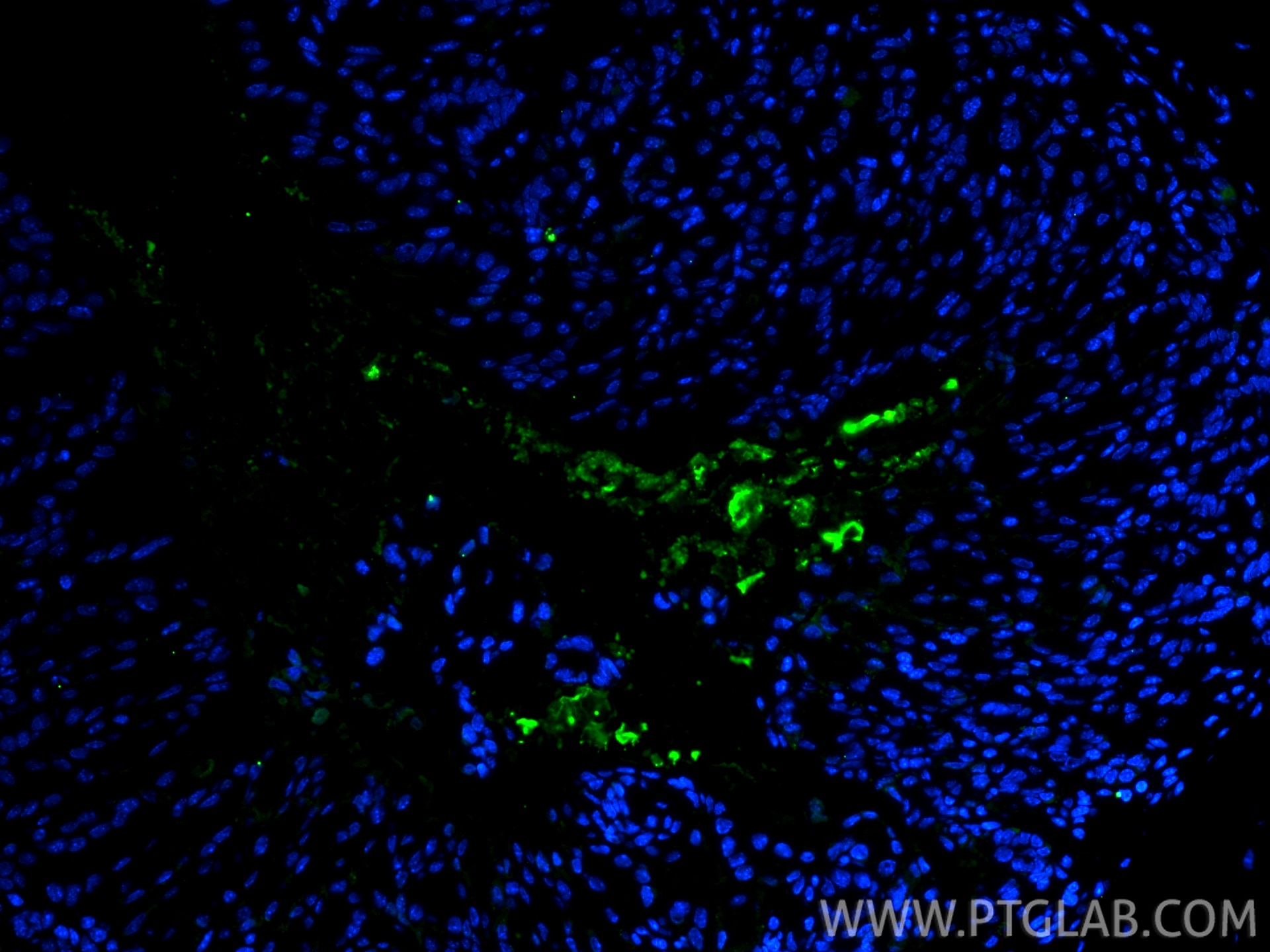 Immunofluorescence (IF) / fluorescent staining of mouse stomach tissue using S100A8 Polyclonal antibody (15792-1-AP)