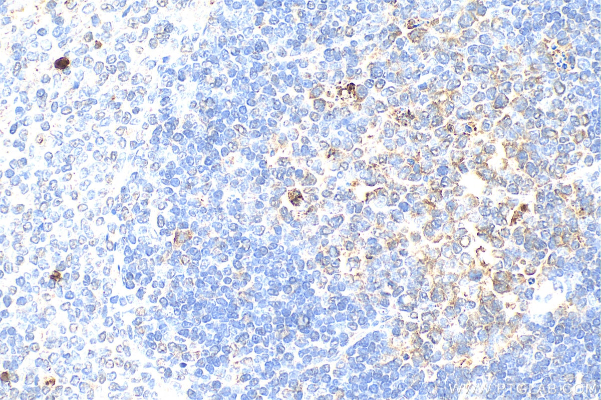 Immunohistochemistry (IHC) staining of rat spleen tissue using S100A8 Polyclonal antibody (15792-1-AP)