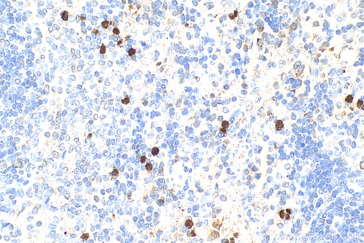 Immunohistochemistry (IHC) staining of rat spleen tissue using S100A8 Polyclonal antibody (15792-1-AP)