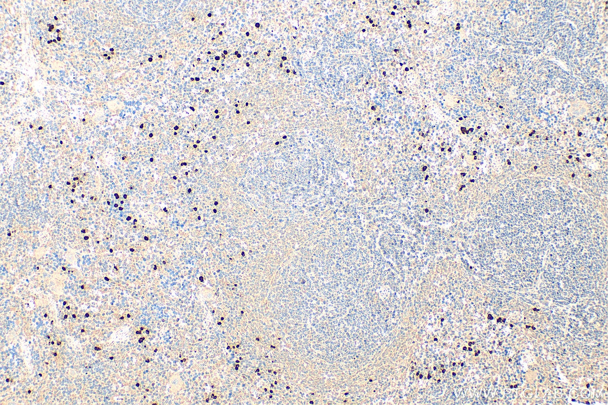 IHC staining of rat spleen using 15792-1-AP Immunohistochemistry (IHC) staining of rat spleen tissue using S100A8 Polyclonal antibody (15792-1-AP)