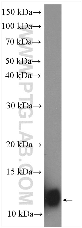 Western Blot (WB) analysis of THP-1 cells using S100A8 Polyclonal antibody (15792-1-AP)