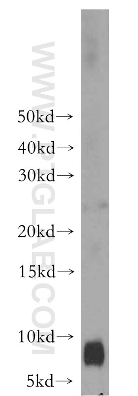 S100A8 Polyclonal antibody