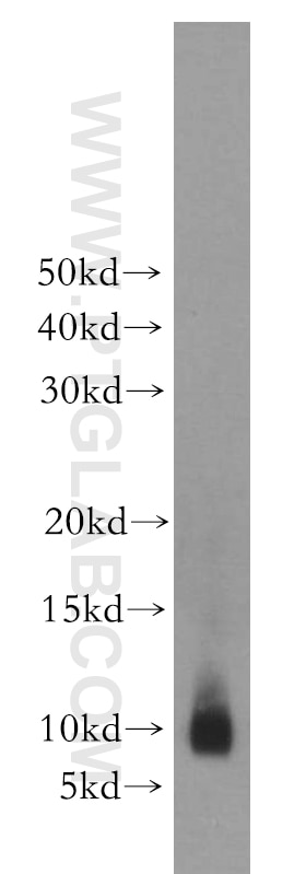 Western Blot (WB) analysis of A549 cells using S100A8 Polyclonal antibody (15792-1-AP)