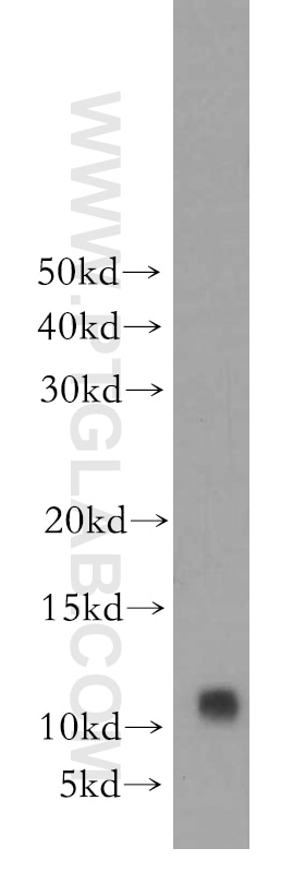 Western Blot (WB) analysis of COLO 320 cells using S100A8 Polyclonal antibody (15792-1-AP)