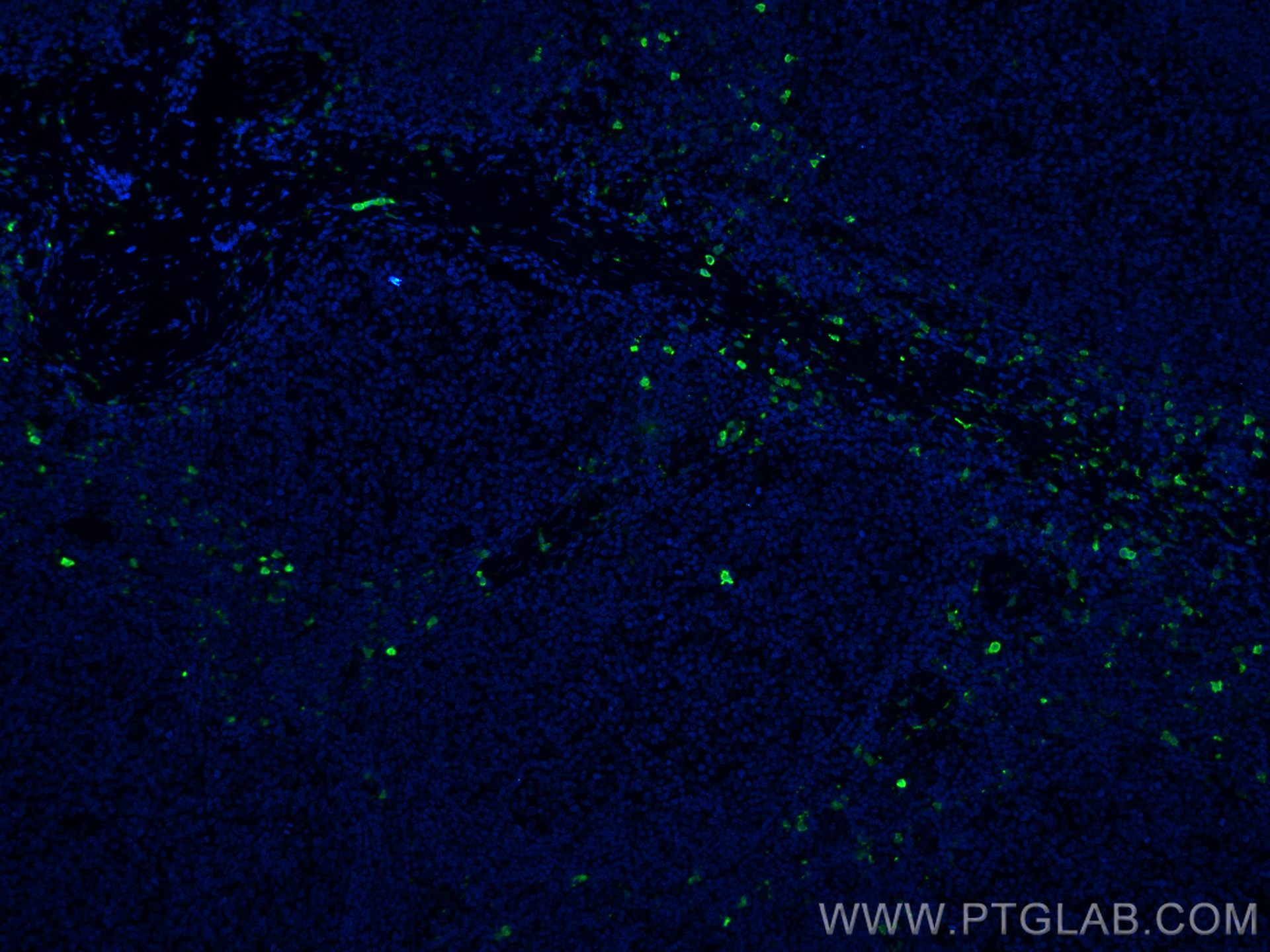 Immunofluorescence (IF) / fluorescent staining of human tonsillitis tissue using S100A8 Monoclonal antibody (66853-1-Ig)