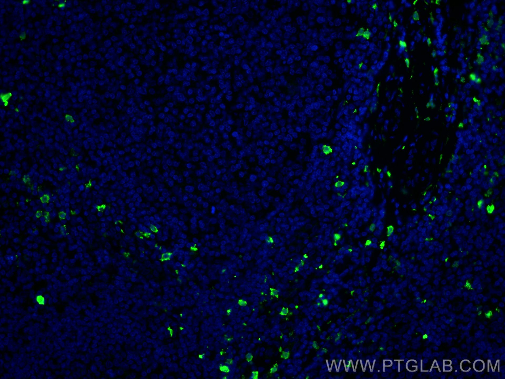 Immunofluorescence (IF) / fluorescent staining of human tonsillitis tissue using S100A8 Monoclonal antibody (66853-1-Ig)