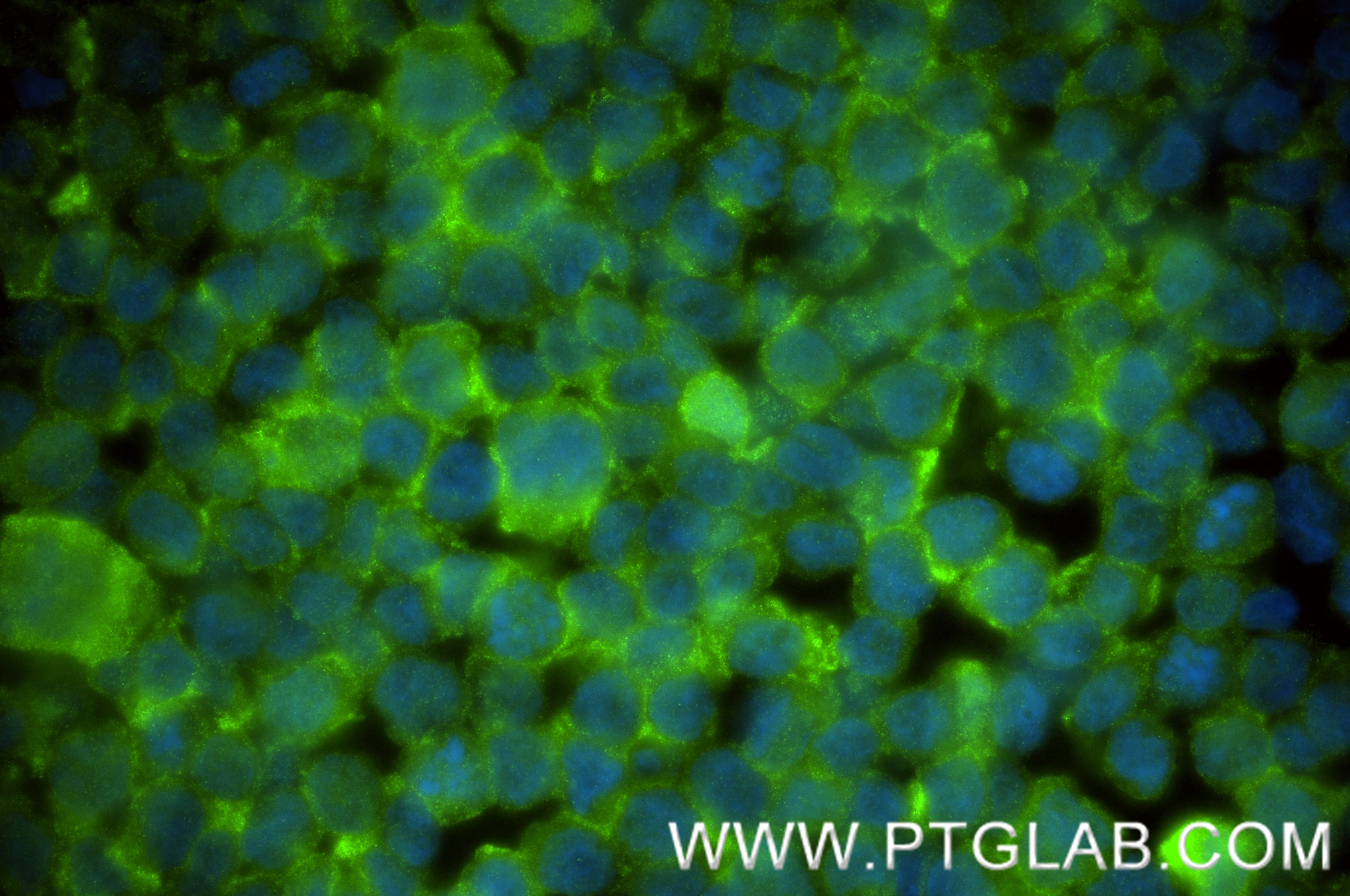 Immunofluorescent analysis of (4% PFA) fixed THP-1 cells using S100A8 antibody (82531-3-RR, Clone: 242970G12 ) at dilution of 1:200 and CoraLite®488-Conjugated Goat Anti-Rabbit IgG(H+L) (SA00013-2). Immunofluorescence (IF) / fluorescent staining of THP-1 cells using S100A8 Recombinant monoclonal antibody (82531-3-RR)