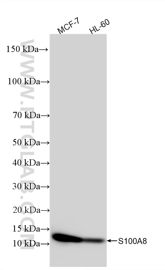 WB analysis using 82531-3-RR Western Blot (WB) analysis of various lysates using S100A8 Recombinant monoclonal antibody (82531-3-RR)
