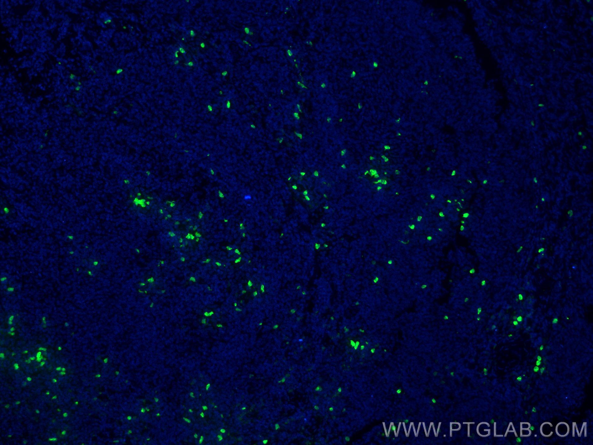 Immunofluorescence (IF) / fluorescent staining of human tonsillitis tissue using CoraLite® Plus 488-conjugated S100A8 Monoclonal an (CL488-66853)