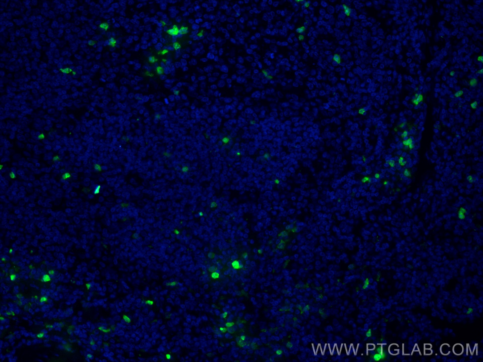 Immunofluorescence (IF) / fluorescent staining of human tonsillitis tissue using CoraLite® Plus 488-conjugated S100A8 Monoclonal an (CL488-66853)